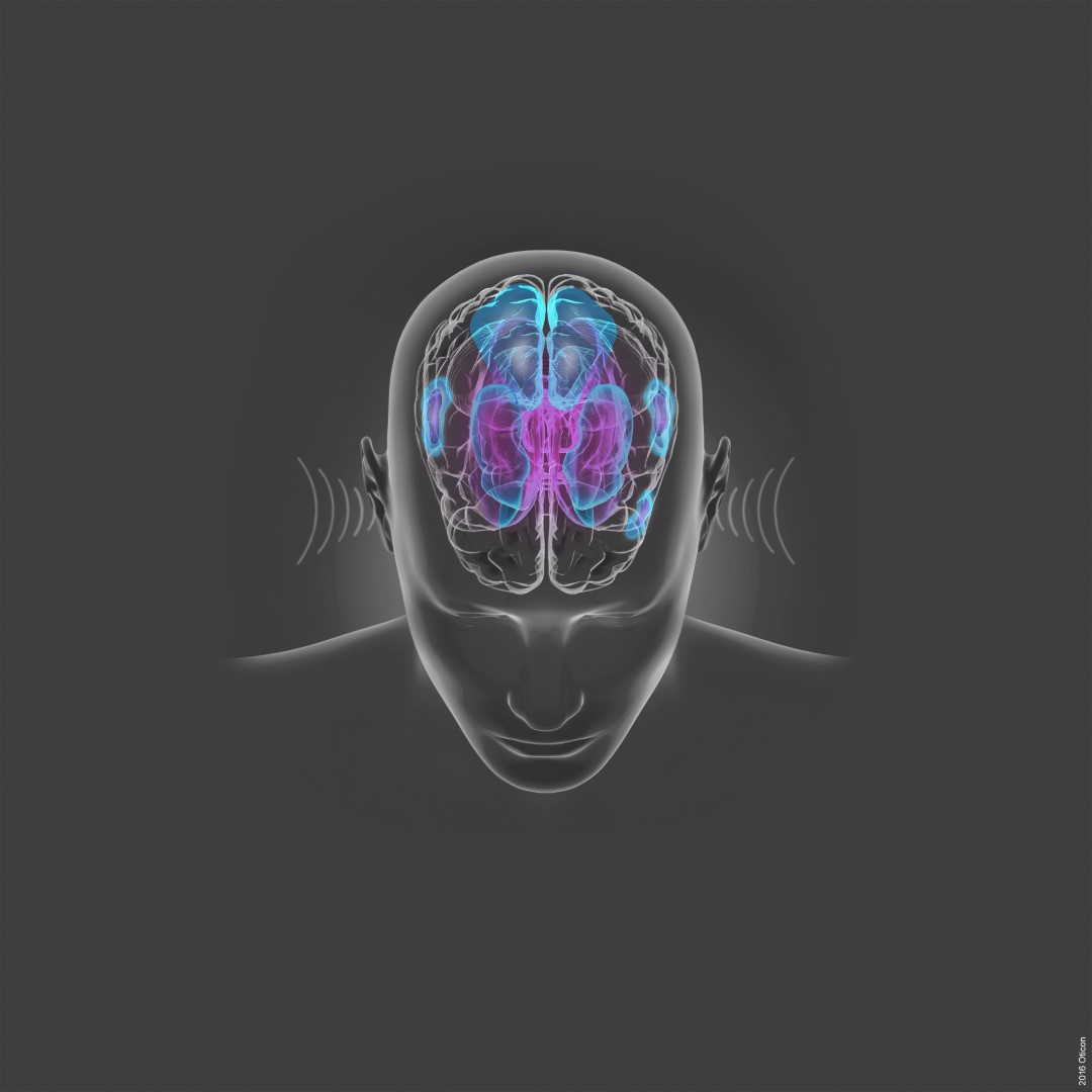 Hearing Loss and the human brain